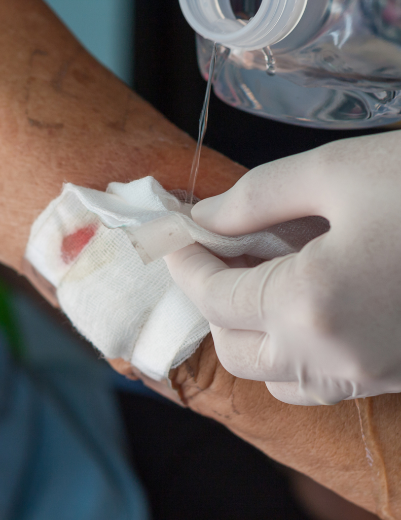 The Basics of Wound Healing: Understanding the Journey